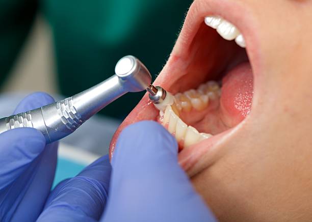 TMJ/TMD Treatment in Hilltop, MN